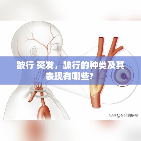 精雕细刻 第2页
