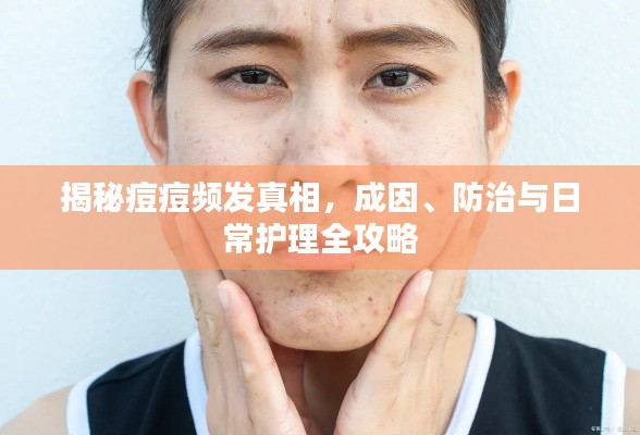 揭秘痘痘频发真相，成因、防治与日常护理全攻略